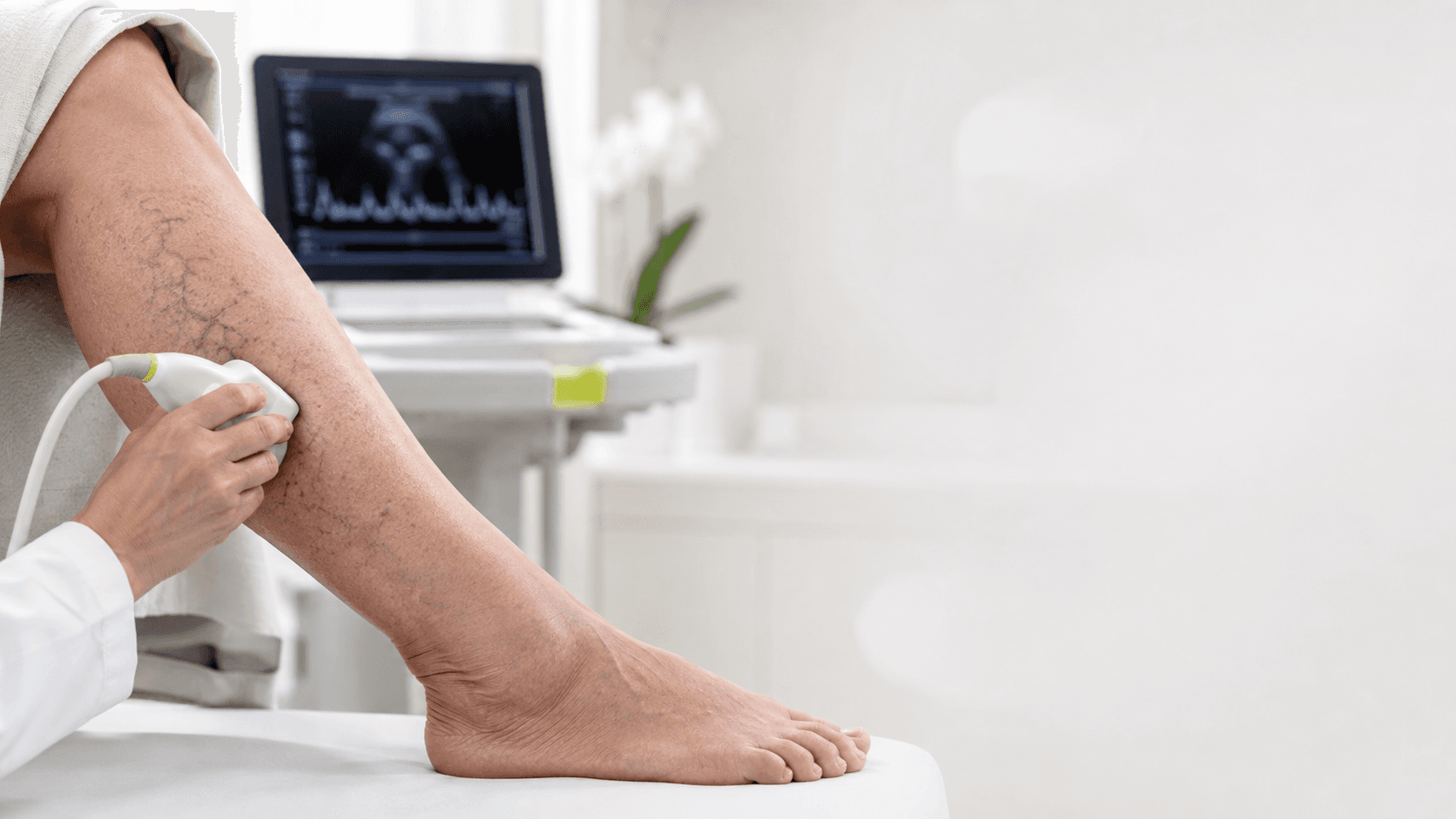 آیا واریس فقط یک مشکل ظاهری است؟
