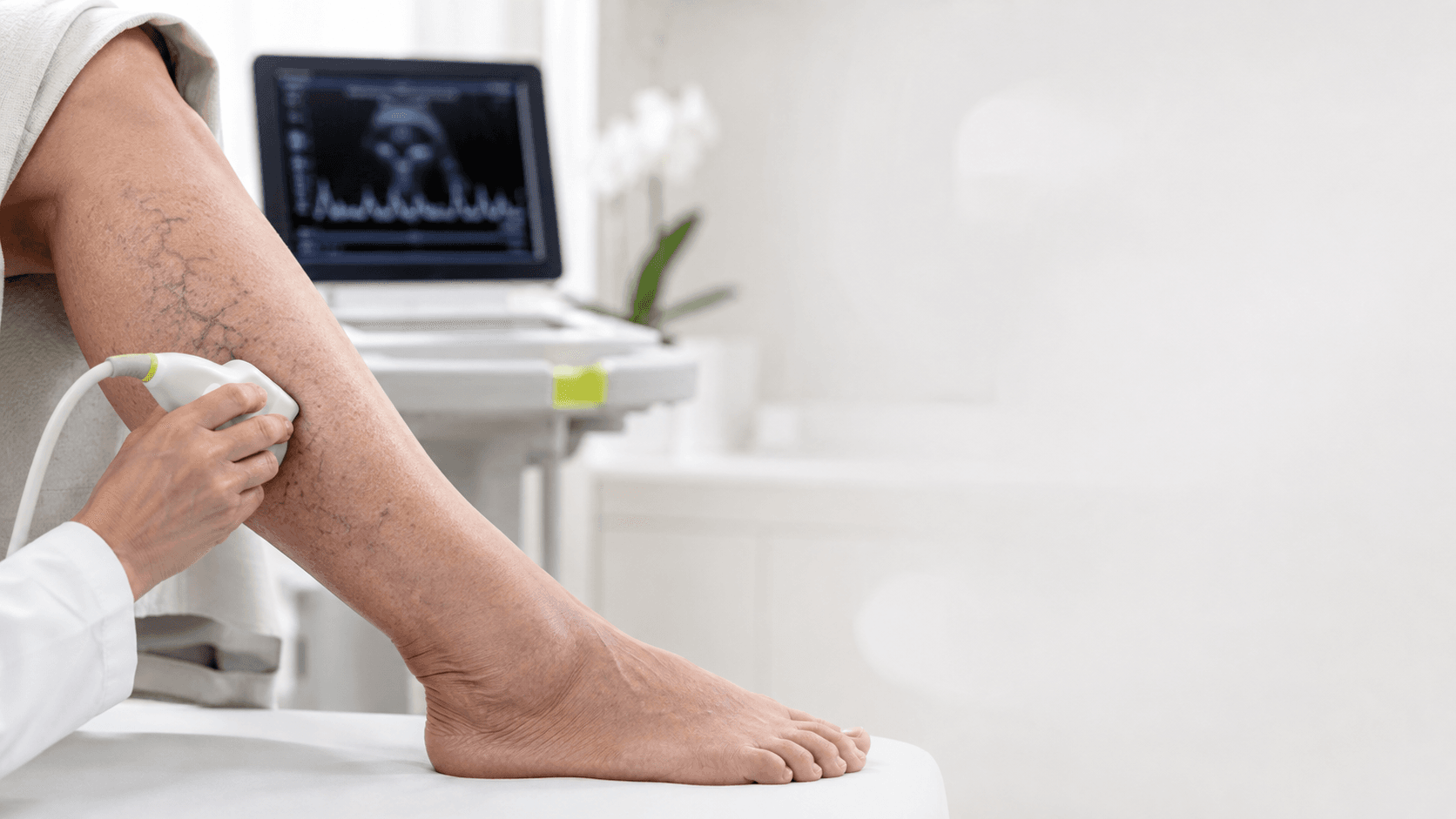 آیا واریس فقط یک مشکل ظاهری است؟